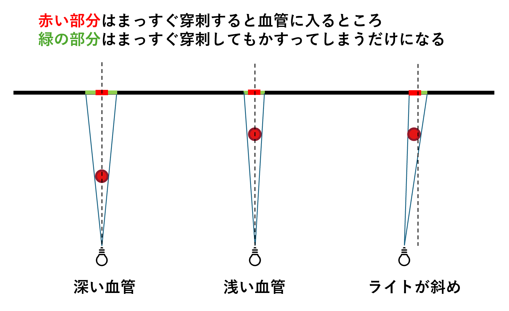 iv_route06.png