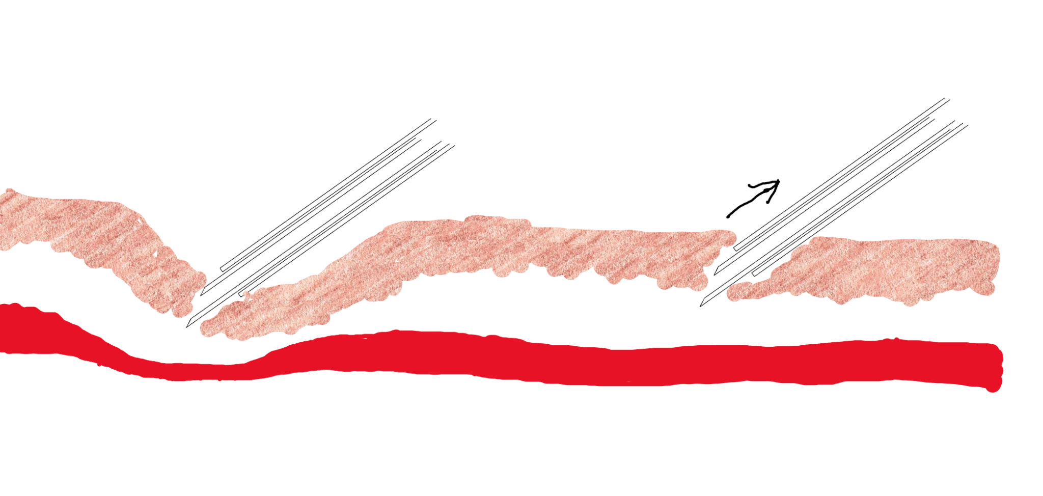 iv_route11.png