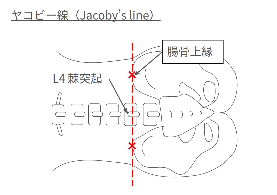 lp2_jacoby_line.png