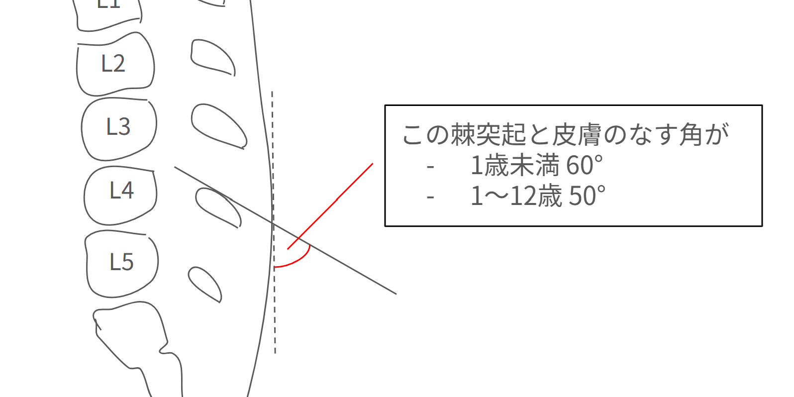lp5_spine_angle.png