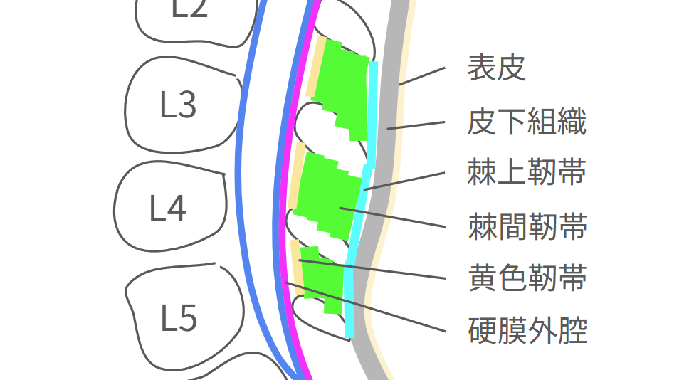lp6_layer.png