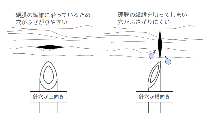 lp7_headache.png